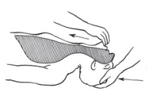 b – udrożnienie dróg oddechowych przez odgięcie głowy ku tyłowi w celu odblokowania zaciśniętych dróg oddechowych