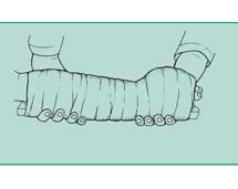 Unieruchomienie nadgarstka i ręki w pozycji fizjologicznej